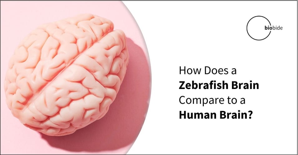 How Does a Zebrafish Brain Compare to a Human Brain?