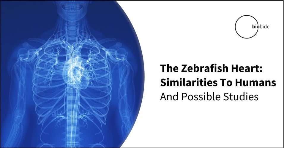 The Zebrafish Heart: Similarities To Humans And Possible Studies