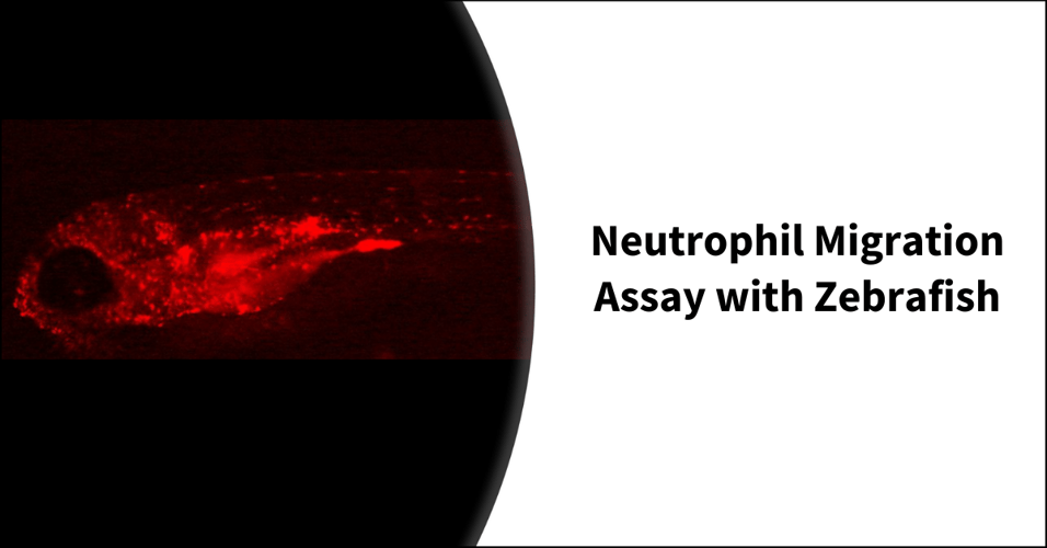Neutrophil Migration Assay with Zebrafish