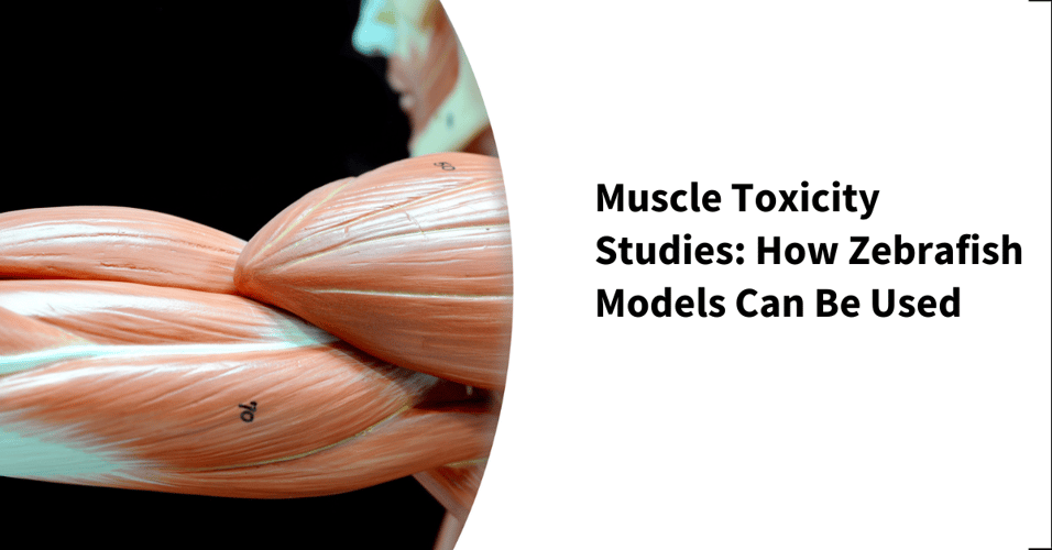 Muscle Toxicity Studies: How Zebrafish Models Can Be Used