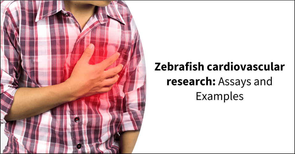 Zebrafish cardiovascular research: Assays and Examples